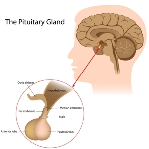  Pituitary Disorders