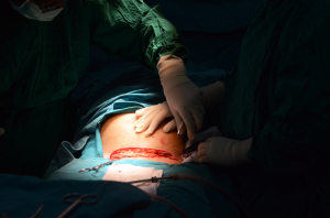  Abnormal Labor (Emergency Cesarean Section)