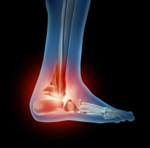  Common Causes Of Ankle Pain