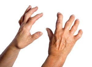 Quercetin Helps Rheumatoid Arthritis Patients