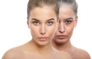 Youthful Skin Heals Better than Old Skin