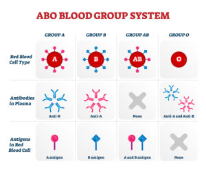 Your blood Group can be a Factor for Developing an Early Stroke