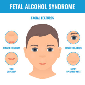 The male Factor Regarding fetal Alcohol Spectrum Disorder